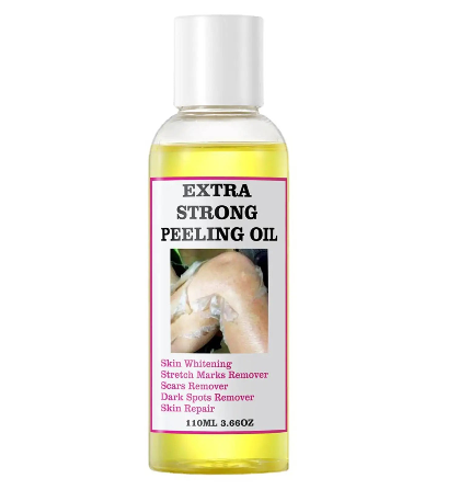 110ml extra strong yellow peeling Oil Whitening Lighter elbows Knees Hands Even skin tone